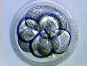 35岁第三代试管婴儿案例：PGS筛查后5枚健康胚胎，移植一次成功！
