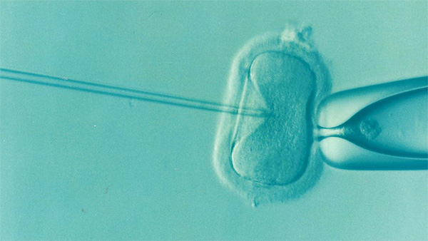 泰国试管婴儿移植的胚胎应该如何选择