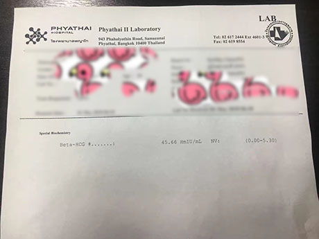 卵巢早衰泰国GL试管成功受孕