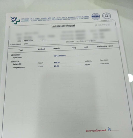 输卵管堵塞泰国试管婴儿一次成功