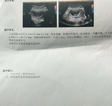 3次怀孕女儿引产后赴泰国试管婴儿成功怀男宝宝