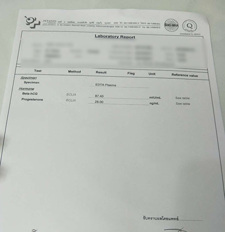 试管成功GPMH4573.JPG 试管成功GPMH4573.JPG